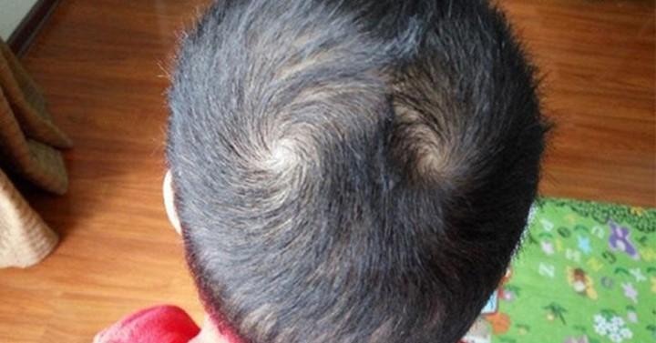 Người có 2 xoáy tóc: Cực kì thông minh, làm nên chuyện lớn, mang số giàu có, đào hoa | Bói Tử Vi