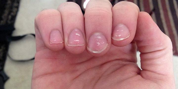 Hạt gạo trên móng tay có ý nghĩa gì? | Bói Tử Vi