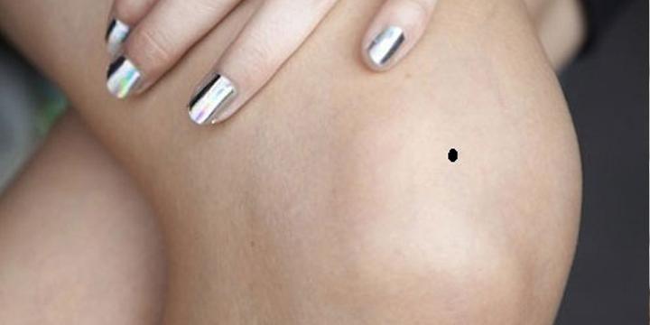 Nối ruồi ở đầu gối mang ý nghĩa gì? | Bói Tử Vi