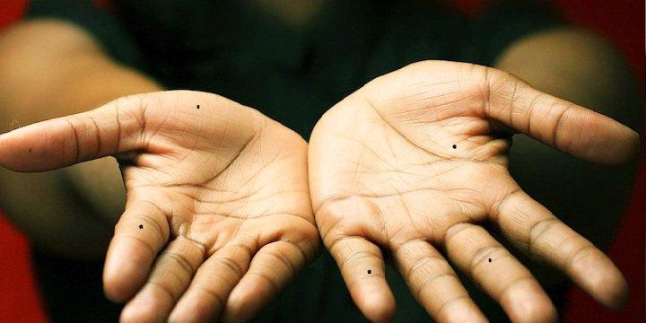 Giải mã mọi thứ về nốt ruồi nằm trên các đốt ngón tay | Bói Tử Vi