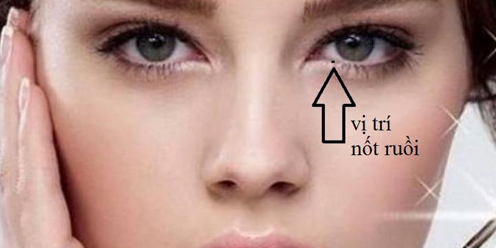 Nốt ruồi trong mắt phải có ý nghĩa gì? | Bói Tử Vi